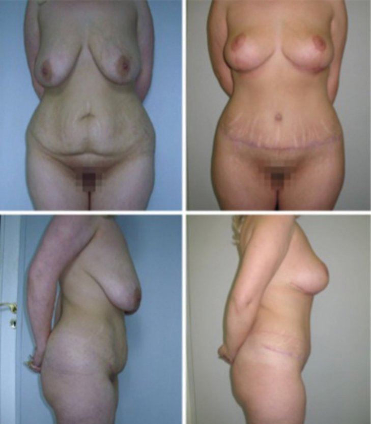 Толстые волосатые лобки