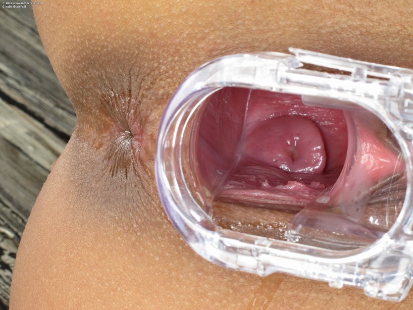 Вагинальный расширитель внутри