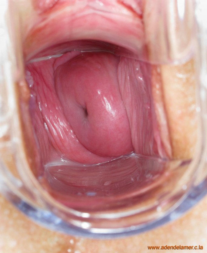 Камера внутри влагалища