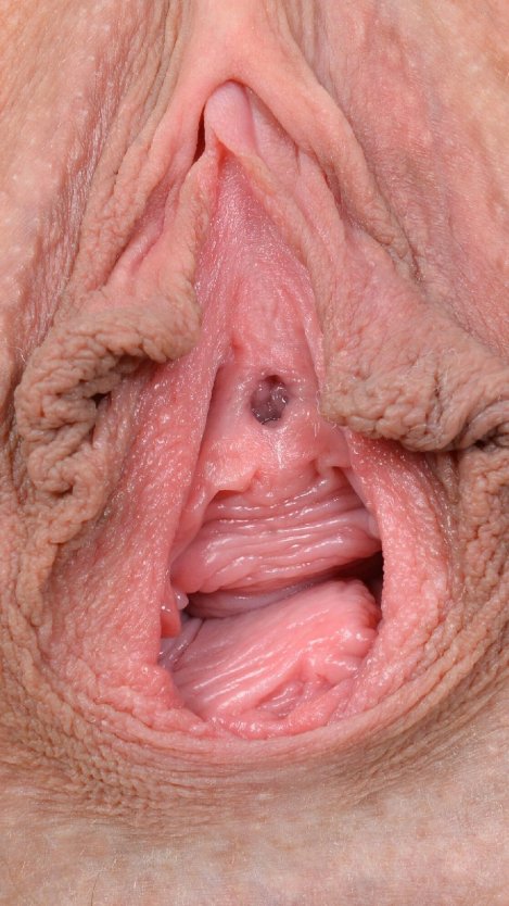 Огромные висячие половые губы