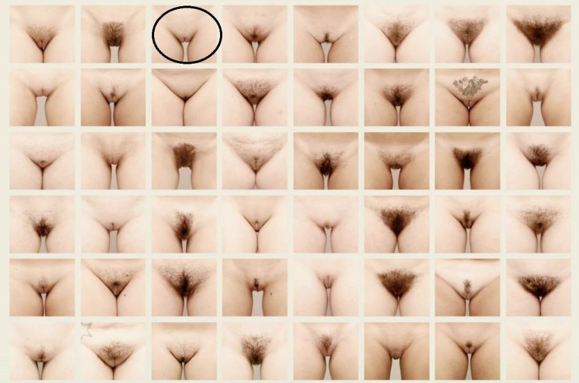 Разновидности женских вагин