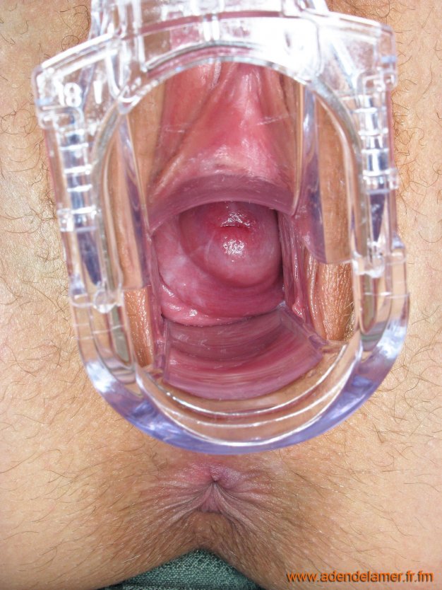 Живые существа во влагалище