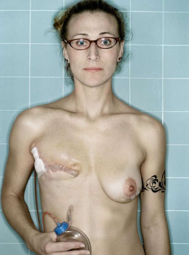 Обвисшая грудь