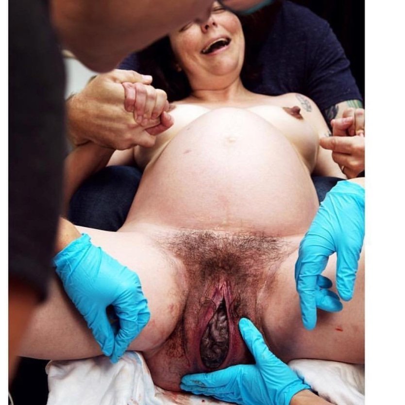 Влагалище женщины после родов