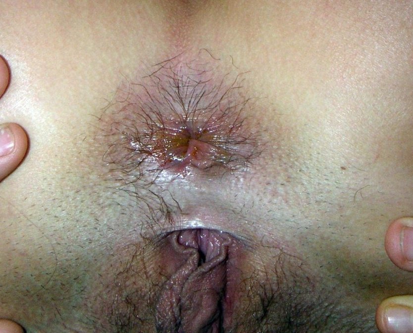 Грязный волосатый анус крупно