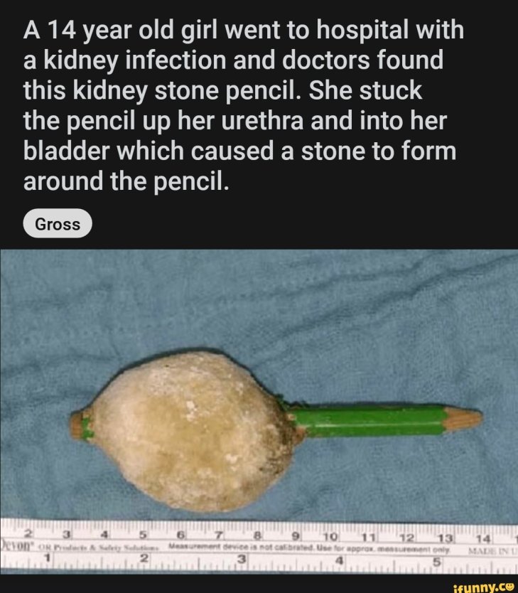 Предметы в уретре у мужчин