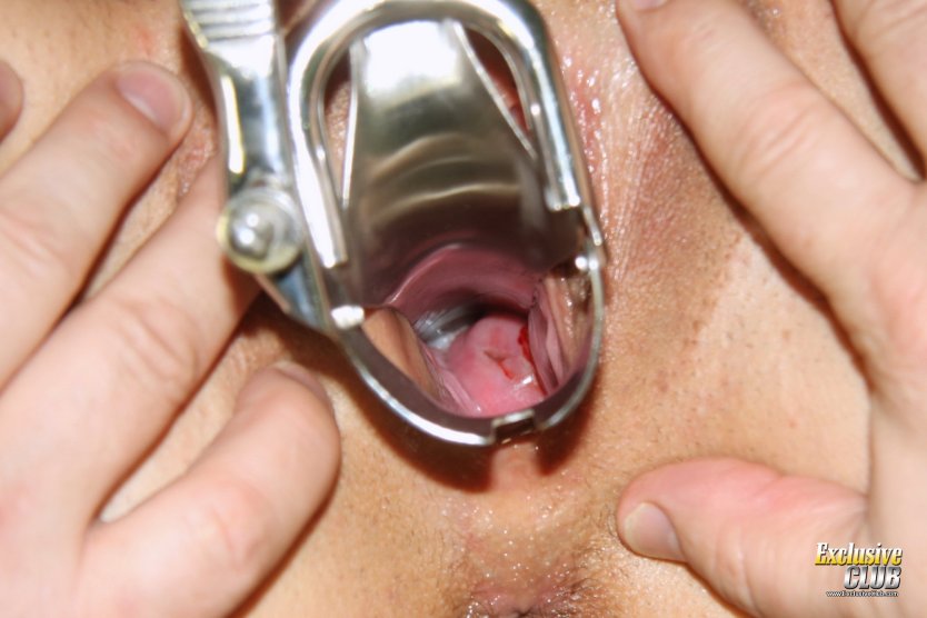 Вагинальное зеркало в вагине