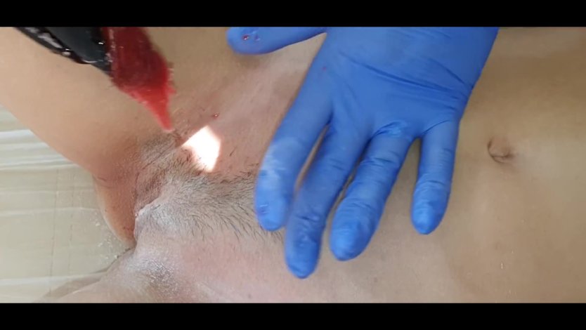 Депиляция глубокое бикини ххх