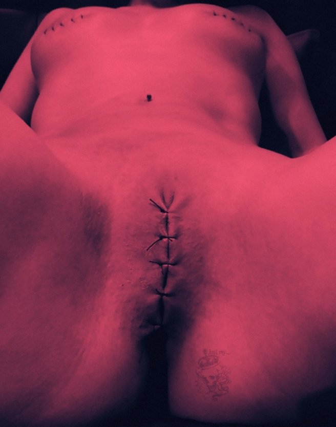 Пирсинг вагина зашивание