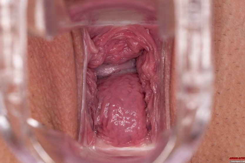 Эро вываливаются внутренности