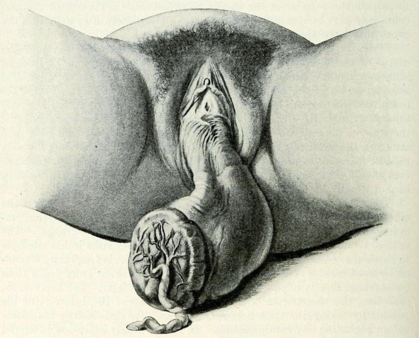 Рисунки женских гениталий