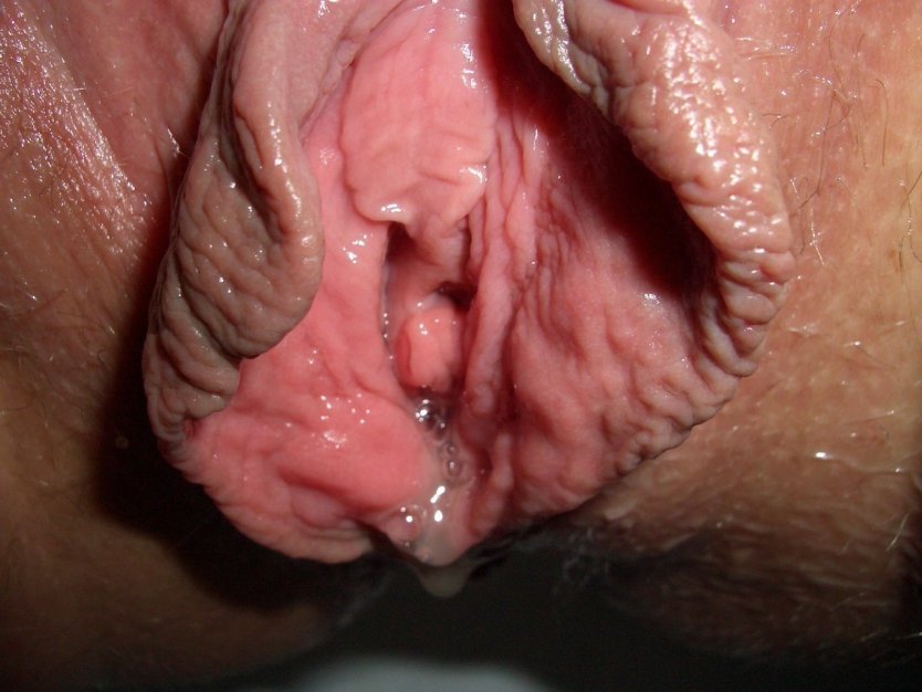 Стенки влагалища изнутри