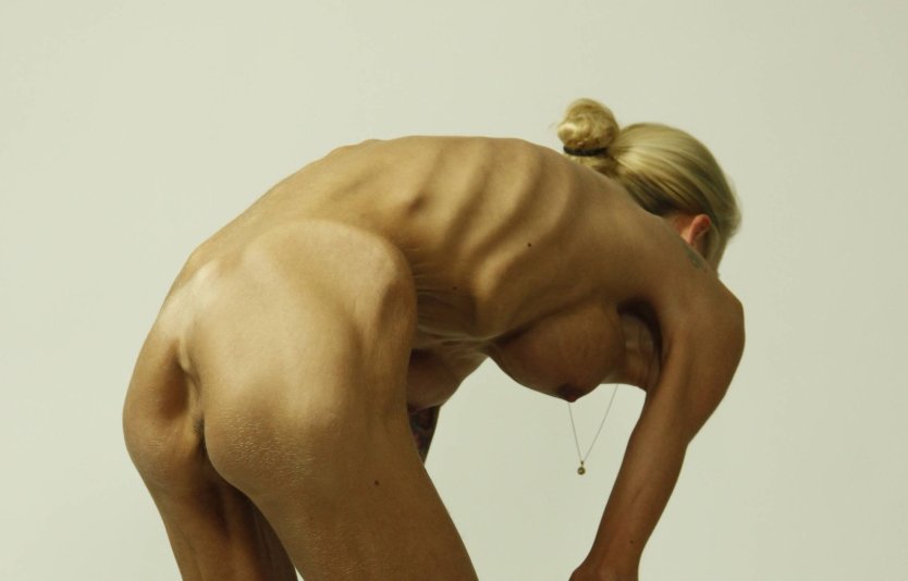 Голые бабы Анорексички