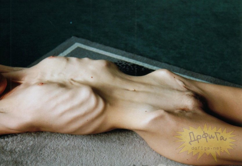 Голые тощие Анорексички