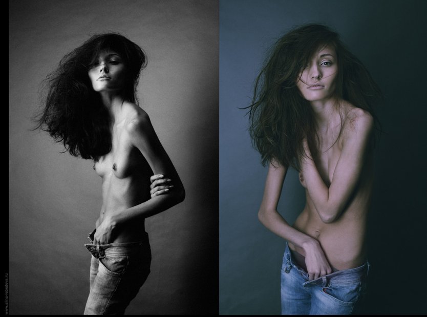 Фотосессия ню Анорексички