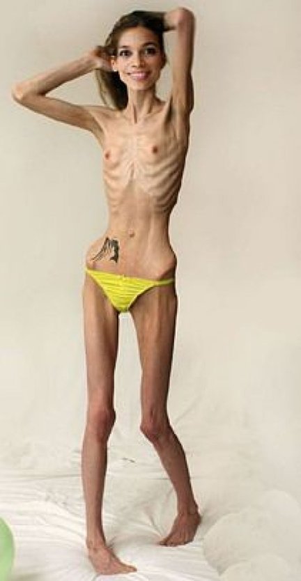 Голые Анорексички девочки