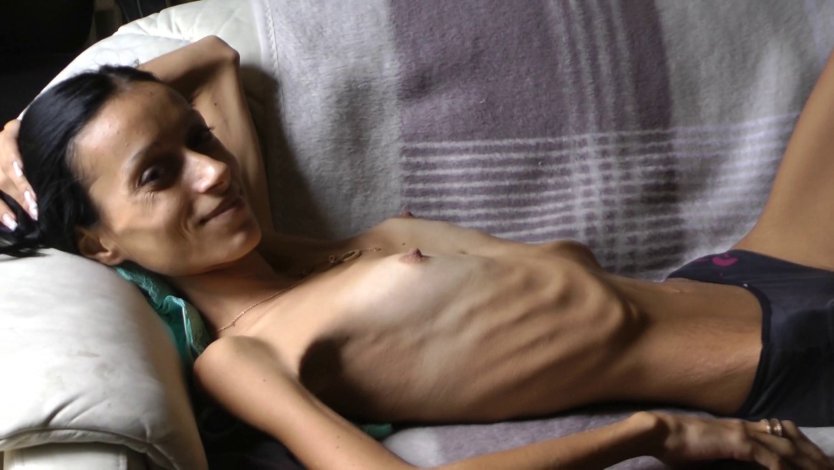 Голая попка Анорексички