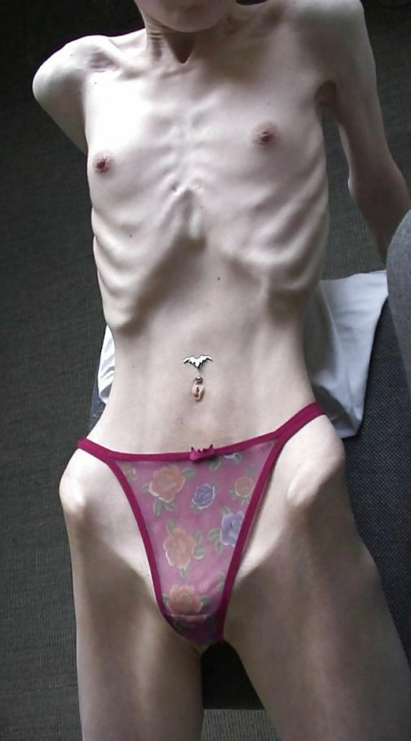 Гениталии Анорексички