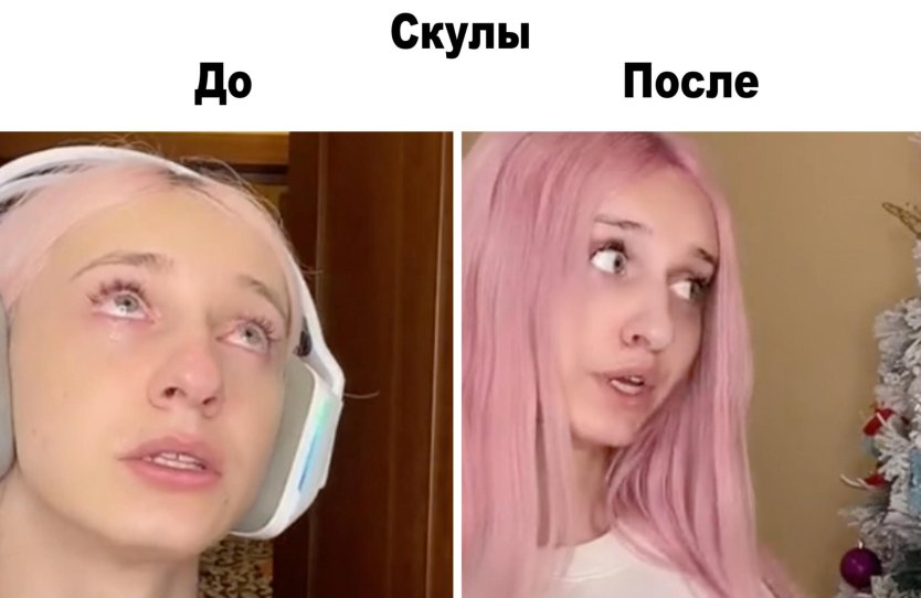 Даша корейка после операции