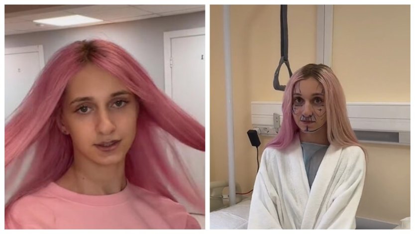 Даша корейка после операции