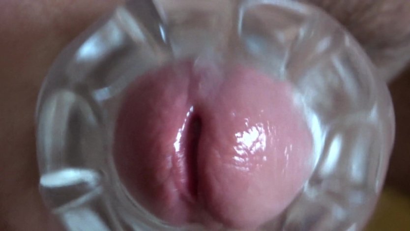 Съемка внутри влагалища