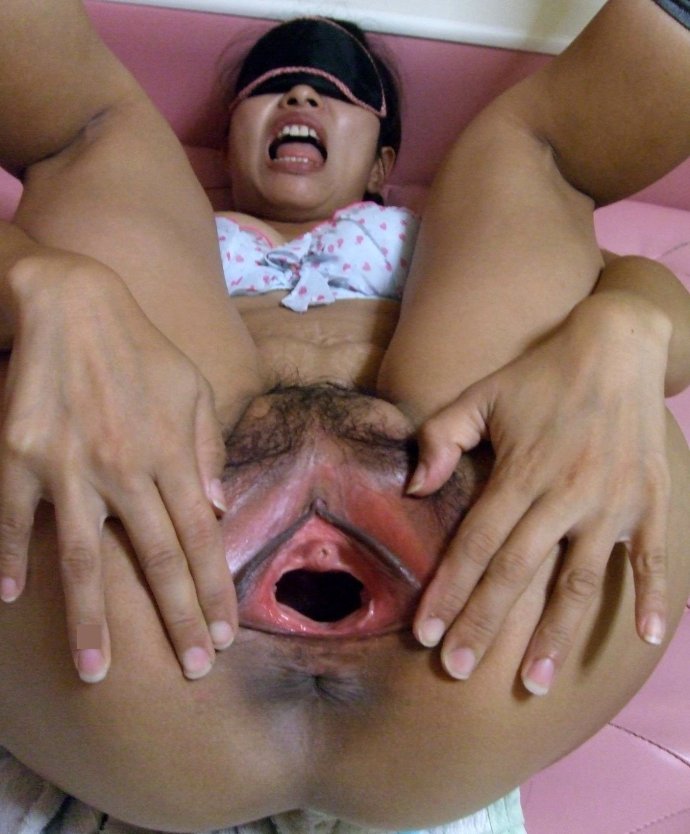 Женщина с большой дырой