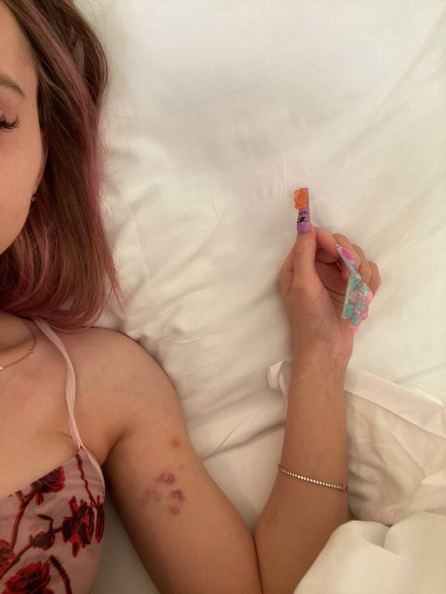 Даша корейка вагинопластика