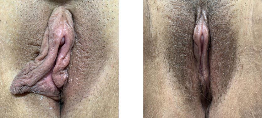 Ххамстер большая лабиа