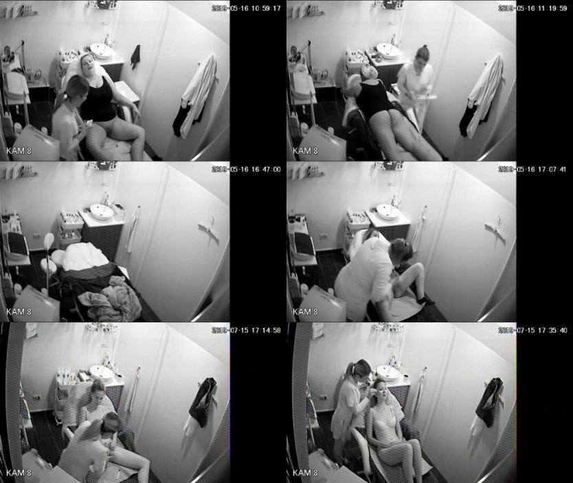 Скрытая камера в гинекологии