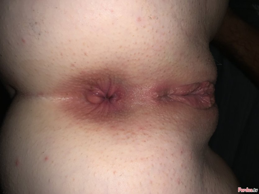 Волосатый женский анус крупным планом